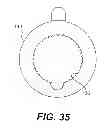 Fig. 32 - Transdermal integrated actuator device, methods of making and using same