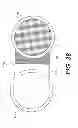Fig. 35 - Transdermal integrated actuator device, methods of making and using same