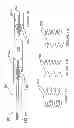 Fig. 06 - Methods and apparatus for renal neuromodulation