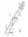 Fig. 02 - METHOD OF PRODUCING SUBSTANCES WITH SUPERSATURATED GAS, TRANSDERMAL DELIVERY THEREOF, AND USES THEREOF