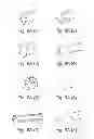 Fig. 14 - INTRACORPOREAL GAS EXCHANGE DEVICES, SYSTEMS AND METHODS