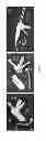 Fig. 04 - Delivery system for in situ forming foams and methods of using the same