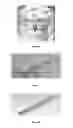 Fig. 07 - Delivery system for in situ forming foams and methods of using the same