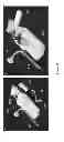 Fig. 10 - Delivery system for in situ forming foams and methods of using the same