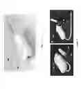 Fig. 11 - Delivery system for in situ forming foams and methods of using the same
