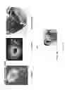 Fig. 18 - Delivery system for in situ forming foams and methods of using the same