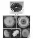 Fig. 23 - Delivery system for in situ forming foams and methods of using the same