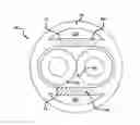Fig. 01 - Noncircular inner lumen guiding catheter with assisted variable support