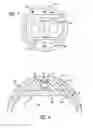 Fig. 04 - Noncircular inner lumen guiding catheter with assisted variable support