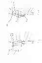 Fig. 10 - Catheter with variable attachment means