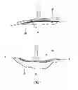 Fig. 02 - Negative Pressure Device for Treating Wounds