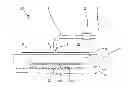 Fig. 01 - Abdominal wound dressing comprising joining means