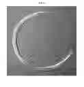 Fig. 07 - BODY CAVITY DRAINAGE DEVICE AND METHODS FOR USING THE SAME
