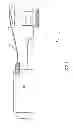 Fig. 02 - Eccentric balloon laser catheter