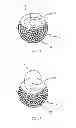 Fig. 06 - Eccentric balloon laser catheter