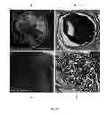 Fig. 09 - COMPOSITE COMPOSITIONS AND APPLICATIONS THEREOF