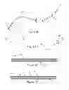 Fig. 02 - Cardiac electrosurgery
