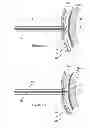 Fig. 09 - Cardiac electrosurgery
