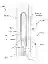 Fig. 01 - Systems, methods, and apparatuses for fusion, stabilization, or fixation of bones
