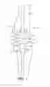 Fig. 02 - Trialing for prosthetic component