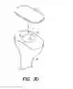 Fig. 07 - Trialing for prosthetic component