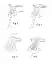 Fig. 02 - Percussion device for bone implantology and operating method thereof