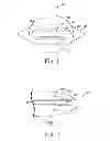 Fig. 02 - Surgical needle system with anchor retention features