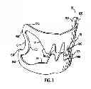 Fig. 02 - Apparatus and method for compressing body tissue