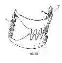 Fig. 22 - Apparatus and method for compressing body tissue