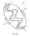 Fig. 35 - Apparatus and method for compressing body tissue