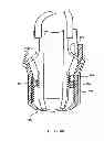 Fig. 45 - Apparatus and method for compressing body tissue