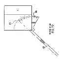 Fig. 71 - Apparatus and method for compressing body tissue
