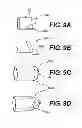Fig. 08 - Apparatuses and methods for cutting a tissue bridge and/or removing a heart valve clip or suture