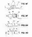 Fig. 09 - Apparatuses and methods for cutting a tissue bridge and/or removing a heart valve clip or suture