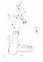 Fig. 02 - TISSUE SEVERING DEVICES WITH SLIDING SUPPORT AND METHODS