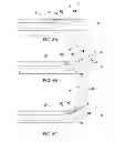 Fig. 07 - TISSUE SEVERING DEVICES WITH SLIDING SUPPORT AND METHODS