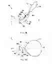 Fig. 09 - TISSUE SEVERING DEVICES WITH SLIDING SUPPORT AND METHODS