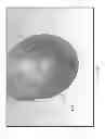 Fig. 02 - SURGICAL DEVICE WITH INTEGRATED VISUALIZATION AND CAUTERIZATION