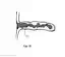 Fig. 08 - Devices, systems, and methods for atrial appendage occlusion