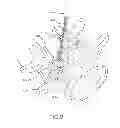 Fig. 08 - Methods and apparatus for stabilizing bone
