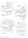 Fig. 02 - Dynamic inter-spinous process spacer