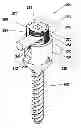 Fig. 01 - Bone screw