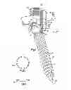 Fig. 02 - METHODS FOR CONNECTING A LONGITUDINAL MEMBER TO A BONE PORTION