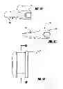 Fig. 07 - Bone fixation device