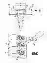 Fig. 09 - Bone fixation device