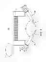 Fig. 02 - Orthopedic compression/distraction device