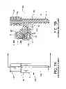 Fig. 09 - Orthopedic compression/distraction device