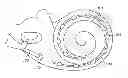 Fig. 01 - Inductive link coupled miniature intra-cochlear elements