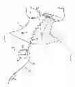 Fig. 01 - Obstructive sleep apnea treatment devices, systems and methods
