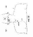 Fig. 09 - Obstructive sleep apnea treatment devices, systems and methods